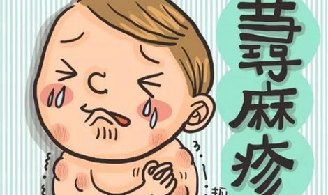 孩子出现急性寻麻疹应该怎么办？